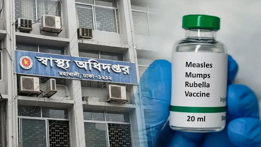হামের উপসর্গে আরও ৫ জনের মৃত্যু, আক্রান্ত ১৩৫৬
